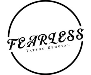 Minnesota Tattoo Removal