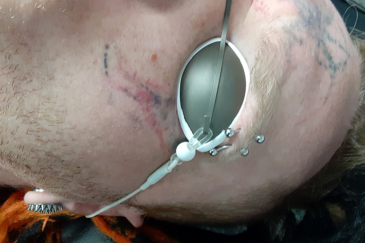 Semi-removed face tattoo with person wearing eye protection